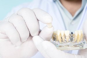 Dentist holding up a model dental implant