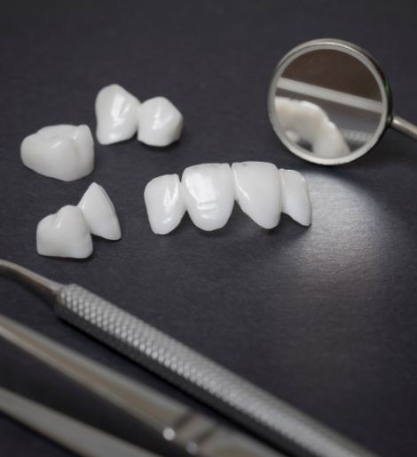 Several white dental crowns and veneers on table next to dental mirror