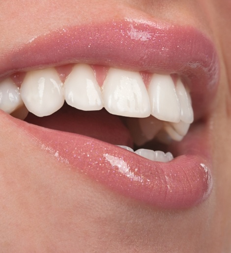 Close up of a smile with flawless white teeth