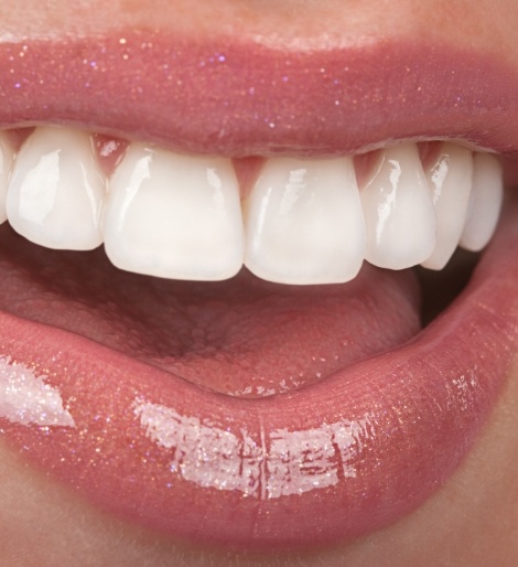 Close up of person smiling with flawless teeth