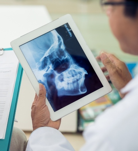 Two dentists looking at an x ray of the jaw