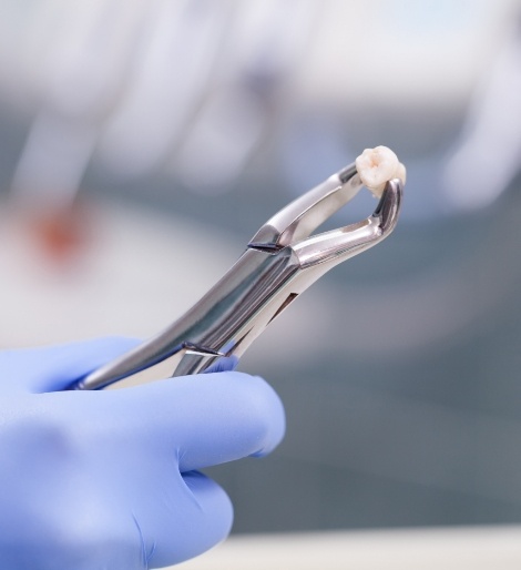 Dentist holding an extracted tooth with a clasp