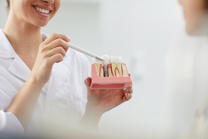 a dentist holding a model of dental implants